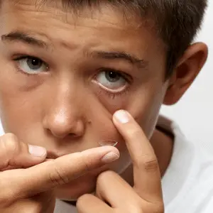 lente de contato pode fazer mal para criança